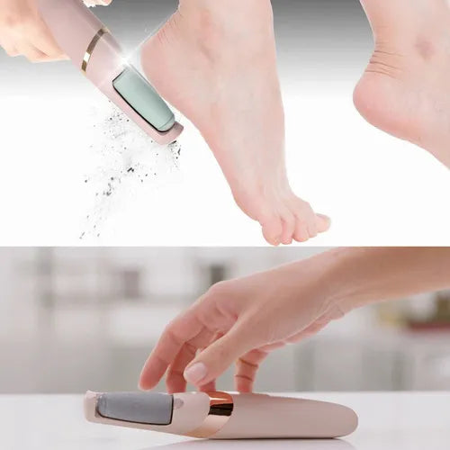 Removedor De Callos inalambrico